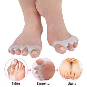 Toe Corrector lábujj távtartó - 1 pár